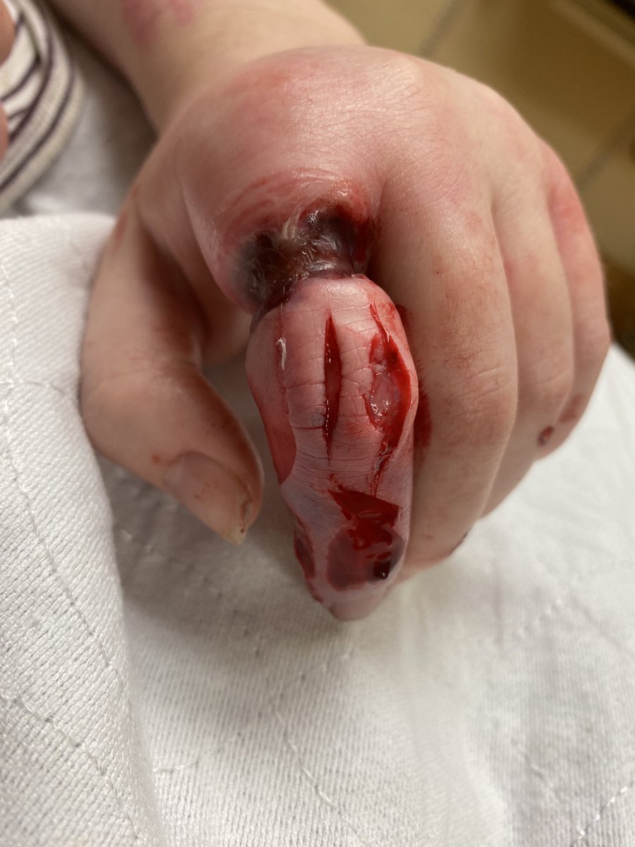 mila 🐞 tweet media