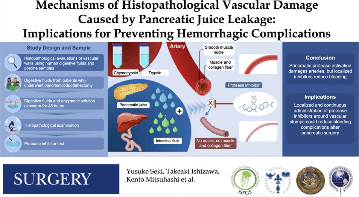 Pancreatic juice leakage 🐳 Mechanisms of histopathologic vascular damage

⚡️ Activation of pancreatic proteases by intestinal fluids 

🩸 Histologic damage to arterial media lead to aneurysm formation

⁉️ Role for administration of protease inhibitors 🧐

surgjournal.com/article/S0039-…