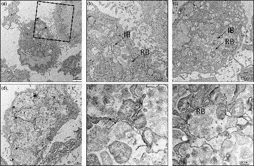 MicrobioSoc's tweet image. Chlamydia vaughanii sp. nov., a novel Chlamydia isolated from a tropical fish (bushymouth catfish). See more in IJSEM: doi.org/10.1099/ijsem.… #IJSEM
