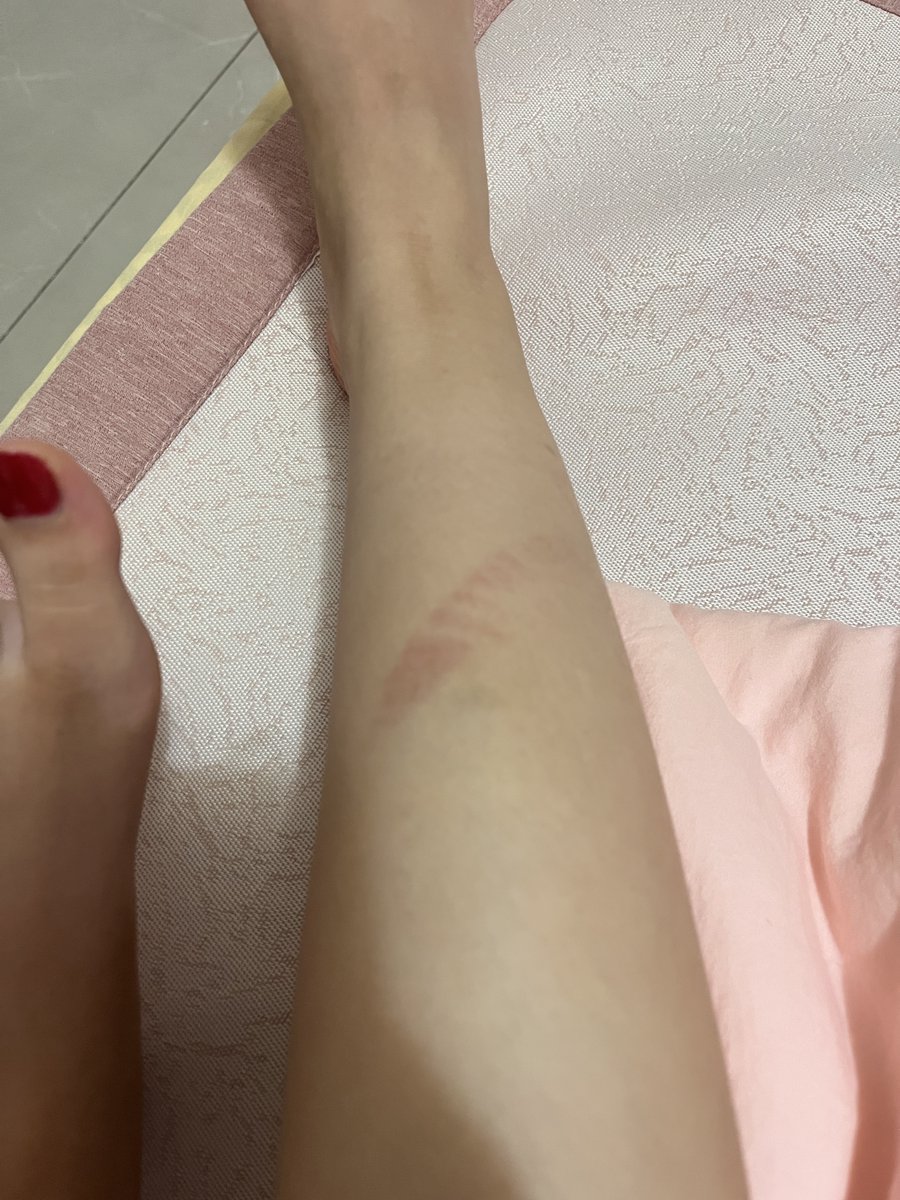 受伤了痛死我…
#女s #裸足 #原味