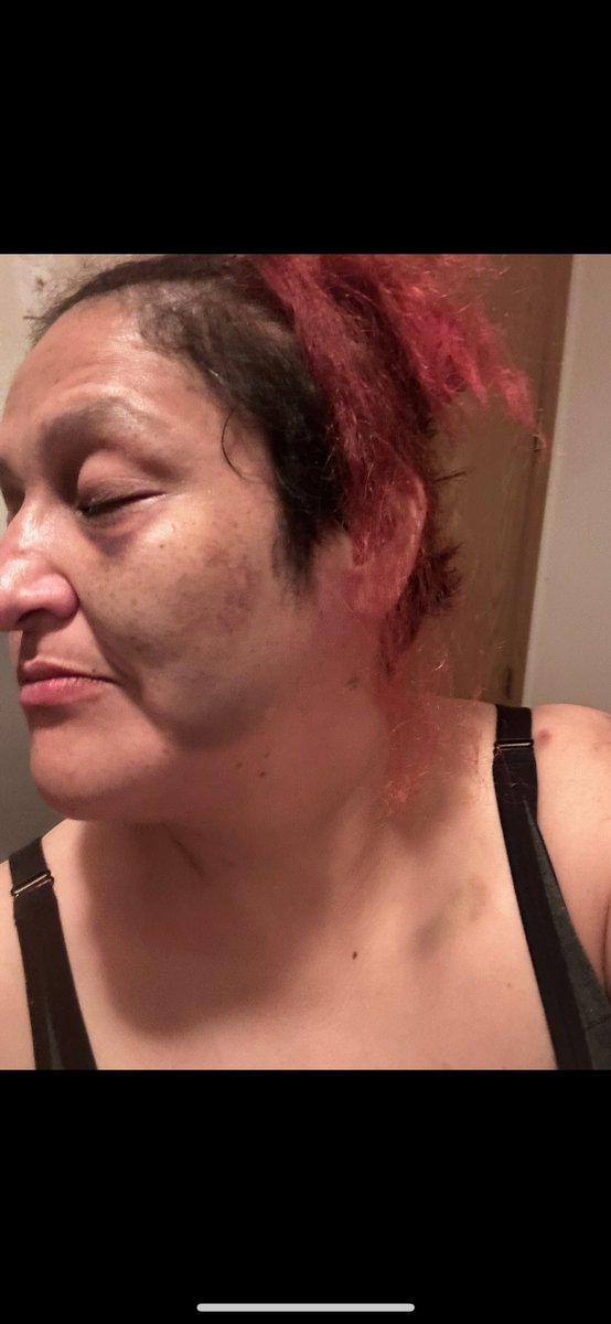 So this is what happens when u don’t remember things and still pay for that and loving or knowing someone. This might land me a first class ticket to heaven but hey, I won’t be crying no rivers going. PPL are messed up…..#stop #violence #tough #guy #rewired #healing