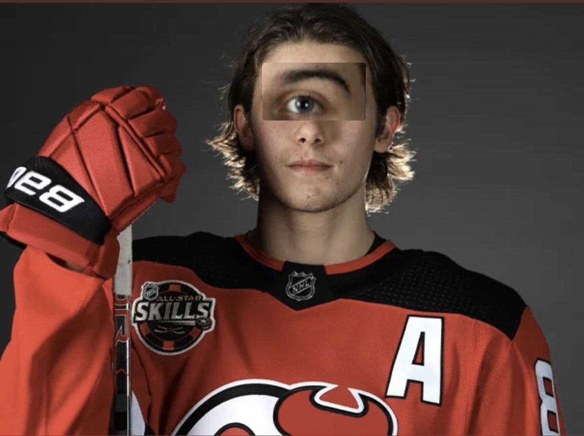 TheBrattPack63's tweet image. Do we prefer Jack Hughes with one eye or two?
