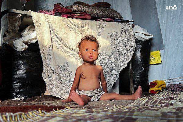 DmodosCutter's tweet photo. Palestinian child, Adham Abu Armana, living in a displacement tent with his mother in Al-Nuseirat refugee camp, suffers from acute malnutrition due to the ongoing Israeli blockade of life saving supplies from entering the Gaza Strip.
#openborderstoaidnow https://t.co/R8kJ5ijWCr