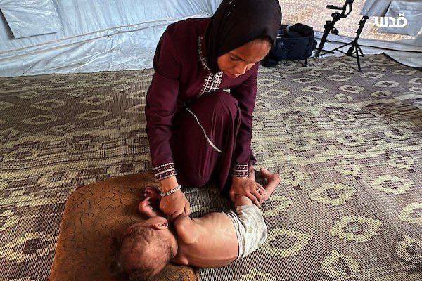 DmodosCutter's tweet photo. Palestinian child, Adham Abu Armana, living in a displacement tent with his mother in Al-Nuseirat refugee camp, suffers from acute malnutrition due to the ongoing Israeli blockade of life saving supplies from entering the Gaza Strip.
#openborderstoaidnow https://t.co/R8kJ5ijWCr