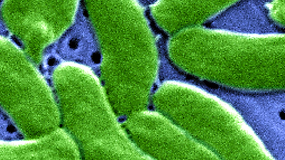MarioNawfal's tweet image. 🚨🇺🇸 FLORIDA’S SUMMER OF FLESH-EATING BACTERIA

At least 30 people are infected and 8 are dead from a surging wave of Vibrio vulnificus in Florida and Louisiana. 

It&apos;s the kind of bacteria that turns a beach day into a nightmare.

This isn’t a new threat, but it&apos;s back with a…