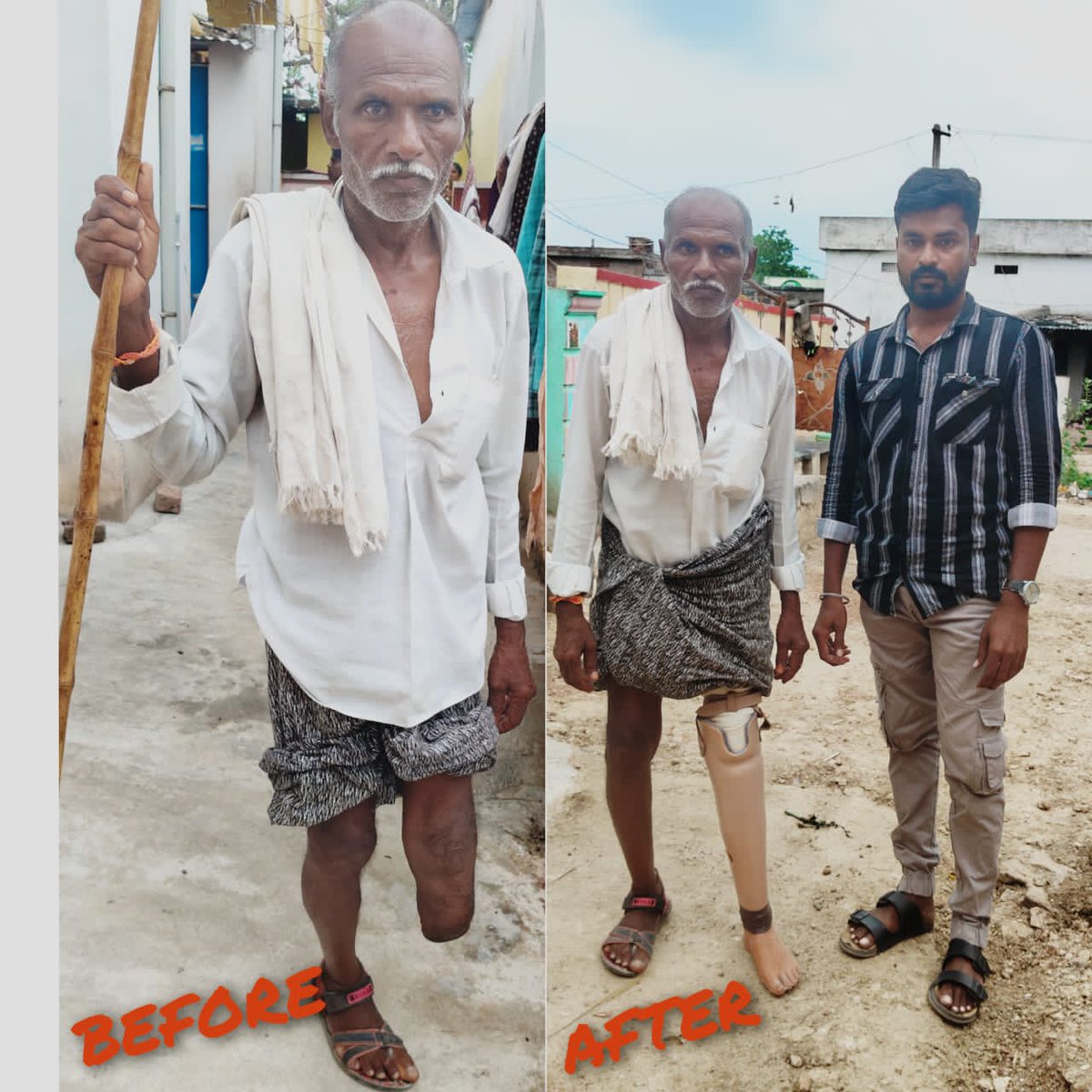 Komarolu village <a href="/A_ArogyaMandir/">Ayushman Arogya Mandir - Arogyam Paramam Dhanam</a>
#CHO S. Srikanth helped road accident victim Narayya get a prosthetic leg through RDT after  months of follow-up. Earlier, he also arranged tricycles for two others. 🙏 #Inspiration #CommunityService
#CommunityHealthOfficer
