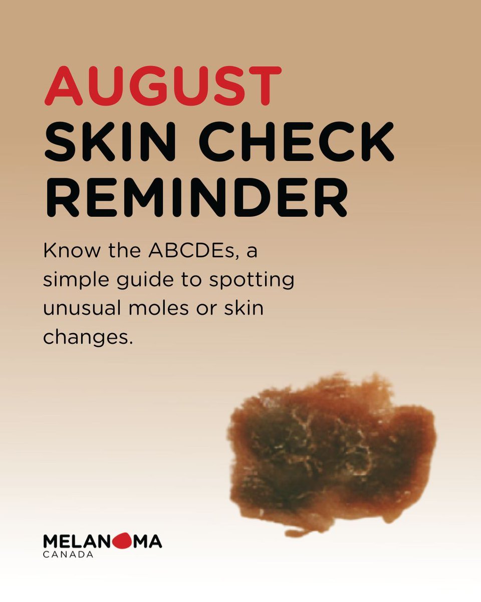 #CheckYourSkin🖤 Tonight’s full moon is the perfect monthly reminder to check your skin. Early detection can save your life. 

Take a few minutes to use the #ABCDEs of melanoma: Asymmetry, Border, Colour, Diameter, and Evolving. These signs can help you spot anything unusual