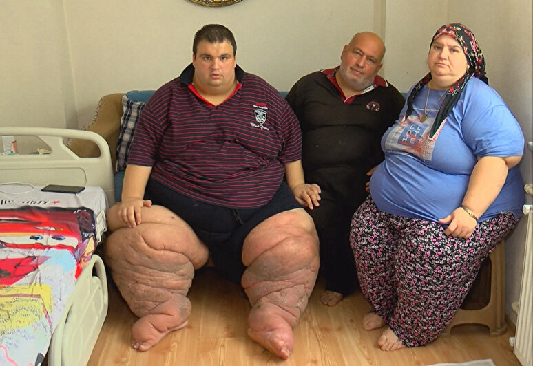 İstanbul'da yaşayan fil hastası Mehmet Arslan, 270 kiloya ulaştı:

"Ben de kafelere gitmek, arkadaşlarımla vakit geçirmek istiyorum ama hiçbir şey yapamıyorum. 15 aydır bu odaya kilitlenip kaldım. 

Bir özel hastane bulduk, 5 milyon lira istendi. Maddi durumumuz olmadığı için