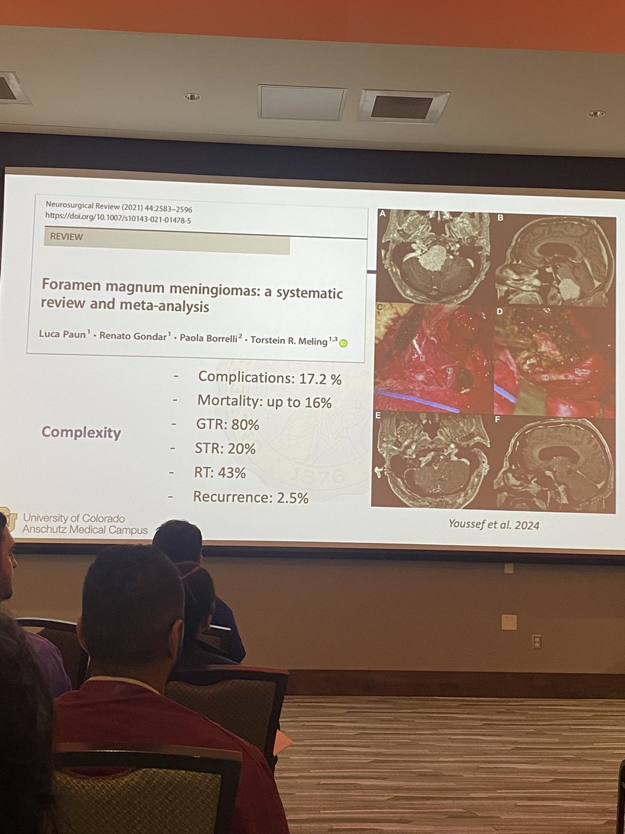Lindy Drollinger (@lindydrollinger) on Twitter photo Dr. Youssef <a href="/ASamyYoussef/">A. Samy Youssef</a> sharing the far lateral approach at the 2025 Carle Illinois Microsurgery and Endoscopic Hands-On Course. <a href="/WHassaneen/">Wael Hassaneen</a> <a href="/CarleHealth/">Carle Health</a> Dr. Youssef <a href="/ASamyYoussef/">A. Samy Youssef</a> sharing the far lateral approach at the 2025 Carle Illinois Microsurgery and Endoscopic Hands-On Course. <a href="/WHassaneen/">Wael Hassaneen</a> <a href="/CarleHealth/">Carle Health</a>
