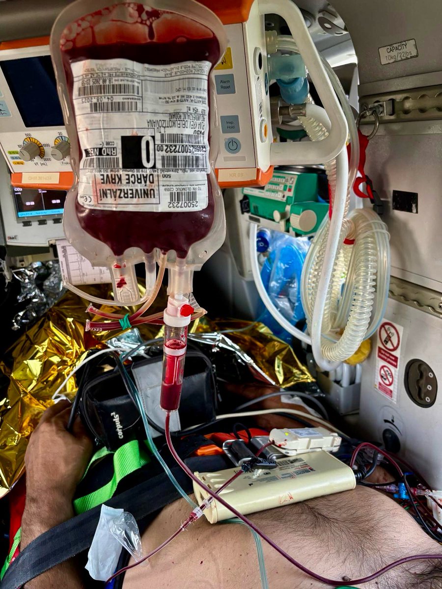 Večerní 🚁 spolupráce se <a href="/zzspak/">ZZS Pardubického kraje</a> u parašutisty, který po pádu z výšky utrpěl  amputaci dolní končetiny společně se zlomeninou stehenní kosti a bérce na končetině druhé. Naši záchranáři podali na palubě transfuzi. 
Transport ad FNOL OUP.

Jedná se o první podání 🩸během prázdnin.