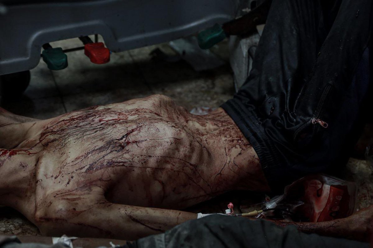 Açlıktan kemikleri sayılan bedenler…
Gazze’de insanlar, sırtları karınlarına yapışmış halde can veriyor.

Etrafları petrol ve lüks içinde yüzen Araplar ise sessiz.

Onlar her türlü ölümle öldürülüyor, Müslümanlar ise yalnızca izliyor.