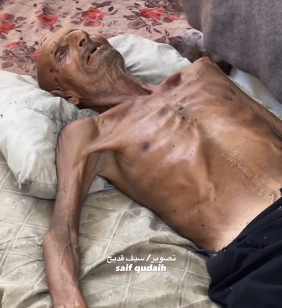 If you’re scrolling, PLEASE leave a dot.

STARVATION.