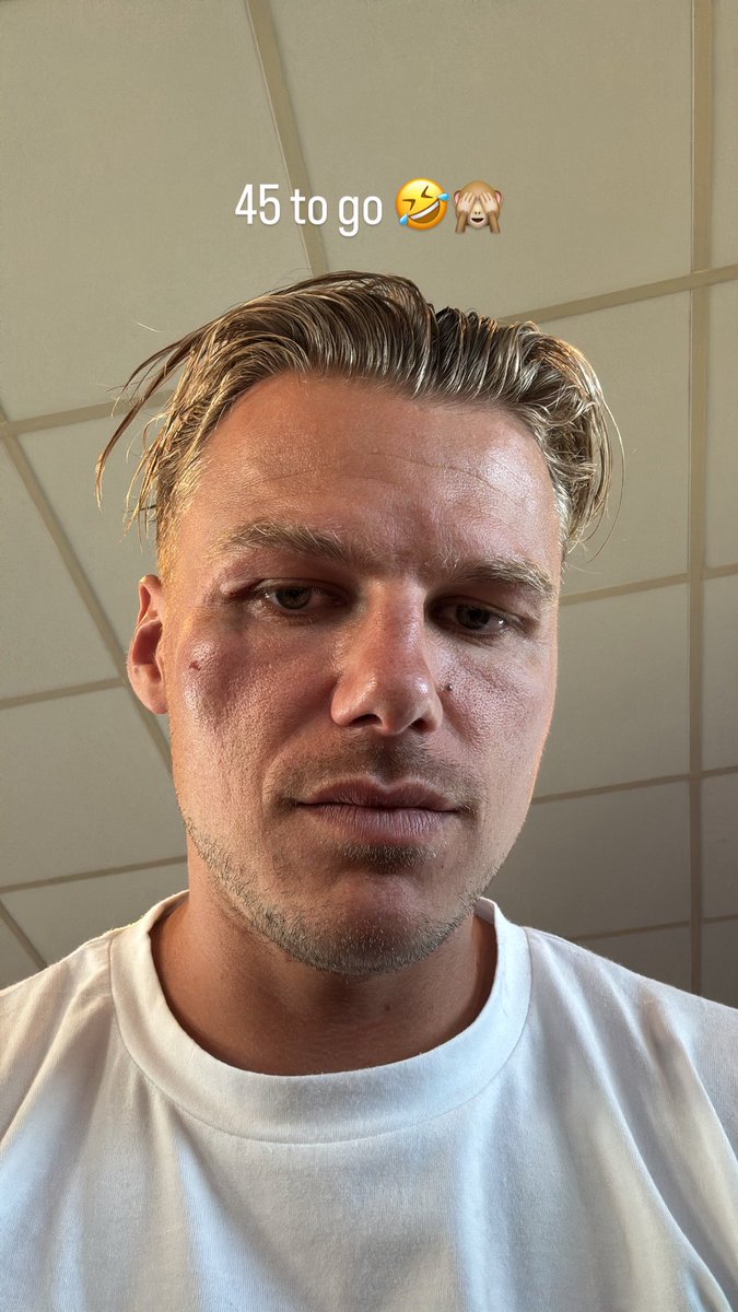 The Rollercoaster begins🎢🤣🐰🐰🤕

<a href="/TUFC1899/">Torquay United FC</a>