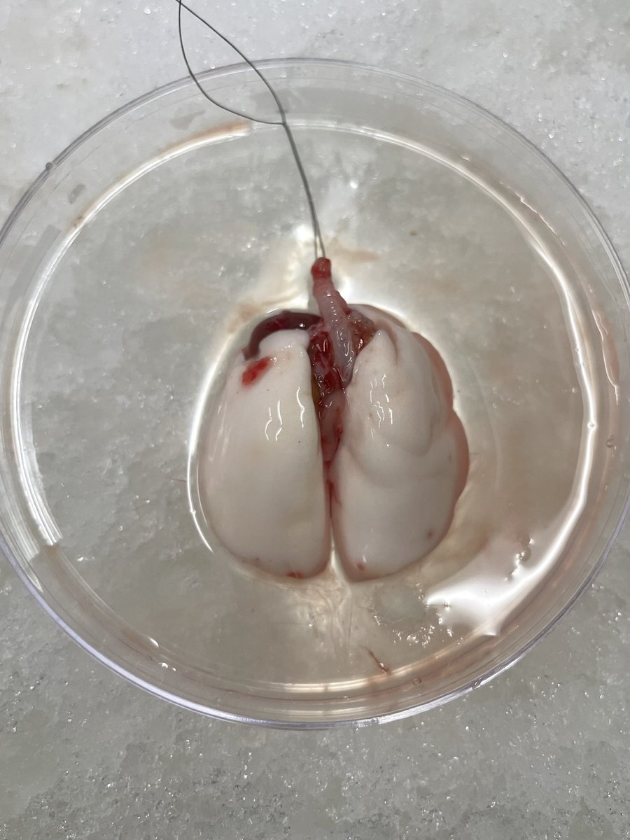 Alexandria (Alex) Soto (@alexandriasoto_) on Twitter photo One year of working with rat lungs complete! 🐀🫁
Grateful to Dr. Matthew Hartwig for his mentorship at the Duke DEVOL Lab (<a href="/Barbas_Hartwig/">Duke Ex Vivo Organ Lab</a>) and to <a href="/DukeMedSchool/">Duke University School of Medicine</a> for honoring our research with the GlaxoSmithKline James B.D. Palmer, MD Memorial Scholarship Fund! 🥼🔬 One year of working with rat lungs complete! 🐀🫁
Grateful to Dr. Matthew Hartwig for his mentorship at the Duke DEVOL Lab (<a href="/Barbas_Hartwig/">Duke Ex Vivo Organ Lab</a>) and to <a href="/DukeMedSchool/">Duke University School of Medicine</a> for honoring our research with the GlaxoSmithKline James B.D. Palmer, MD Memorial Scholarship Fund! 🥼🔬