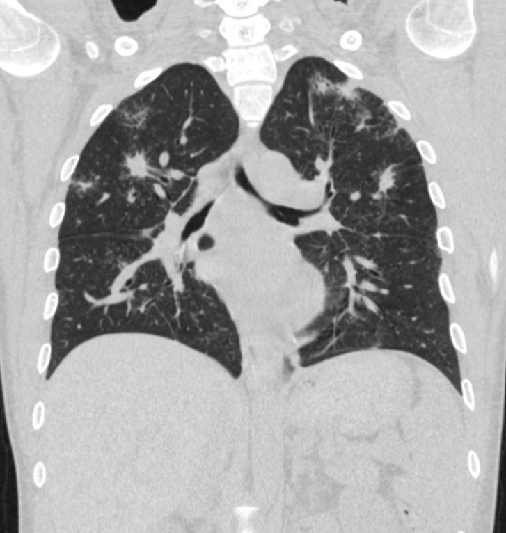 Radiology Tutorial Cases (CT,MRI) (@Ganymade__) / Posts / X