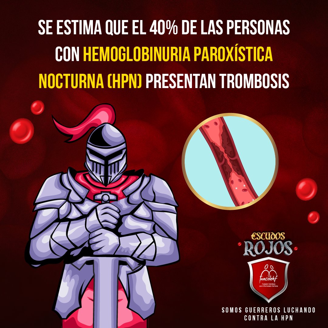 La trombosis es la formación de un coágulo sanguíneo que bloquea el flujo normal de la sangre. Si se desprende, puede viajar a otros órganos causando problemas graves
Es común en personas con #HemoglobinuriaParoxísticaNocturna. Detectarla a tiempo es crucial.
💚
#FUNCOLEHF #HPN