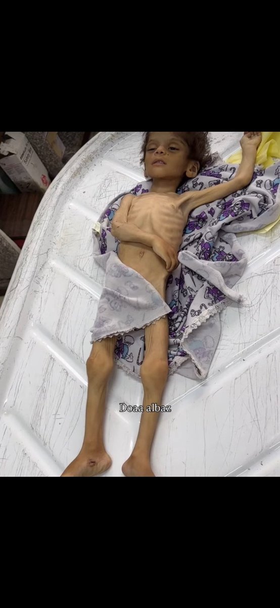 2 Milyar Müslüman
Terörist İsrail'i kınıyor❗️