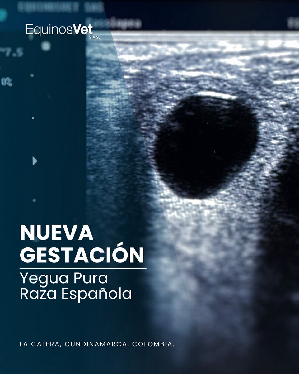 ¡Ver una gestación no solo confirma un procedimiento exitoso, también nos recuerda por qué amamos lo que hacemos!

Ecografía confirmando una nueva gestación producto de inseminación artificial con el gran reproductor El Gorrión LA. 

Seguimos materializando sueños en #LaCalera.