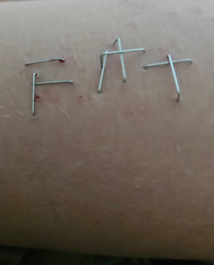 vOdkacong0mitas's tweet image. shit