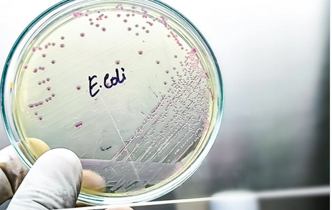 Seventure Partners (@seventurep) on Twitter photo New <a href="/Columbia/">Columbia University</a> university study: 🦠BACTRINS uses #CRISPR🧬 to disarm toxic #bacteria without killing them - avoiding dangerous toxin release that happens with antibiotics 💊 Potential game-changer for E. coli infections! 👉 ow.ly/7La150WwxAV <a href="/cenmag/">C&EN (Chemical & Engineering News)</a> #Microbiome New <a href="/Columbia/">Columbia University</a> university study: 🦠BACTRINS uses #CRISPR🧬 to disarm toxic #bacteria without killing them - avoiding dangerous toxin release that happens with antibiotics 💊 Potential game-changer for E. coli infections! 👉 ow.ly/7La150WwxAV <a href="/cenmag/">C&EN (Chemical & Engineering News)</a> #Microbiome