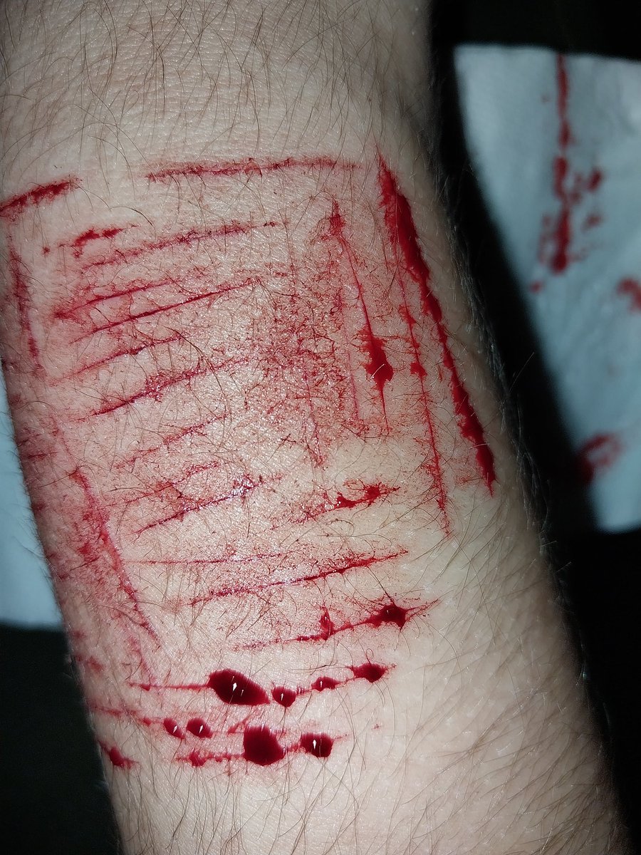 ⚠︎▴якαzє▴⚠︎ tweet media