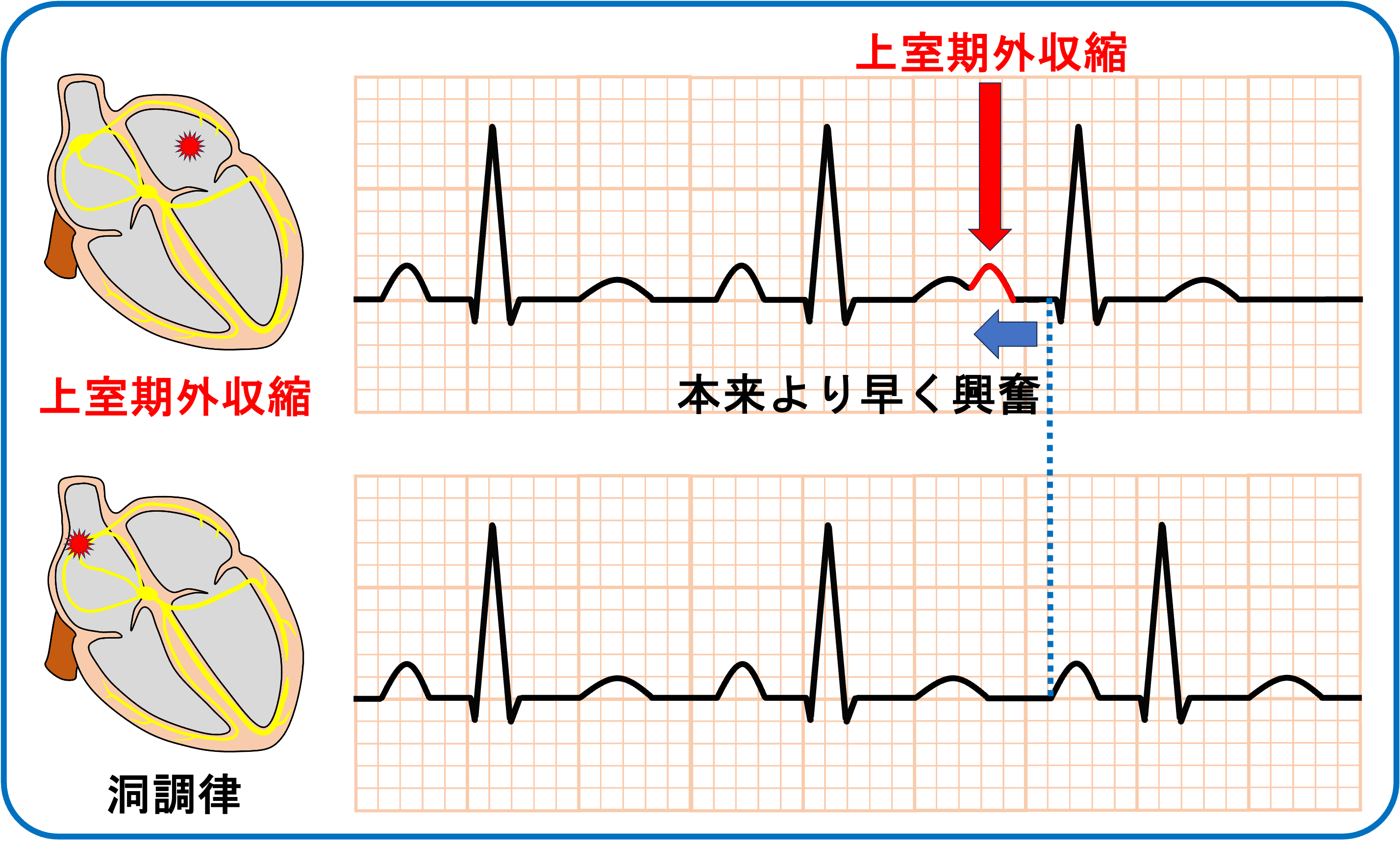 心電図.com (@sindenzu1) / X