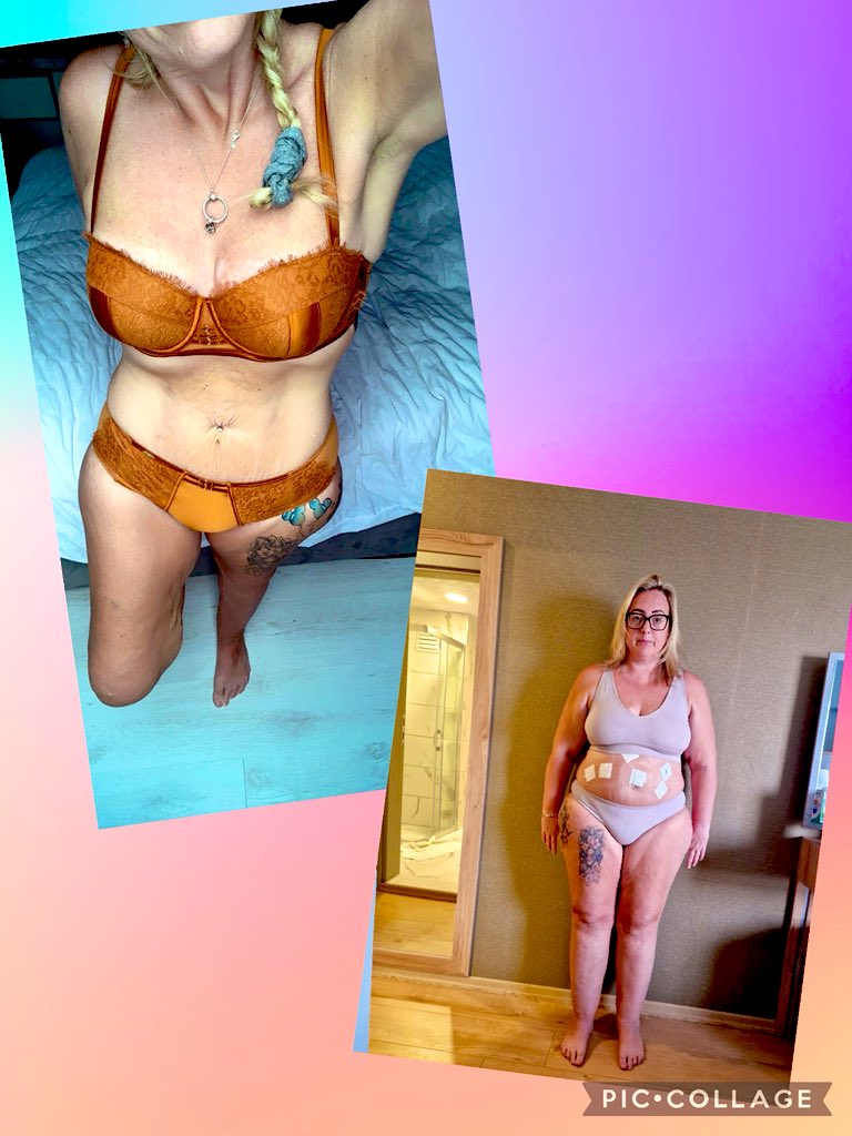 Transformation Tuesday 
I’m almost 2yrs now and am super proud of my journey and the person I am today 
From size 20 size 12 
My life has transformed so much in 24months 
I was miserable in a dead end marriage scared of being judged.
But I changed and for the better ❤️👌🏻