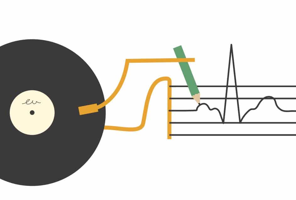 慢性腎臓病の高血圧には蛋白尿を評価せよ！　【高血圧学会ガイドライン公開１か月前】 mizuno-lab.jp/all/%e6%85%a2%…