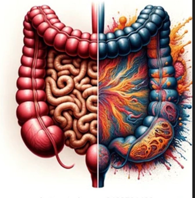 🦠 "Tüm hastalıklar bağırsakta başlar." - Hipokrat

Sağlığınızın temel taşı sindirim sisteminizdir. Eğer ona odaklanırsanız, hayatınızdaki pek çok şey yerine oturur!

📌 İşte sindirim sorunlarını tanımak ve çözmek için 7 kritik nokta:

(FLOOD)