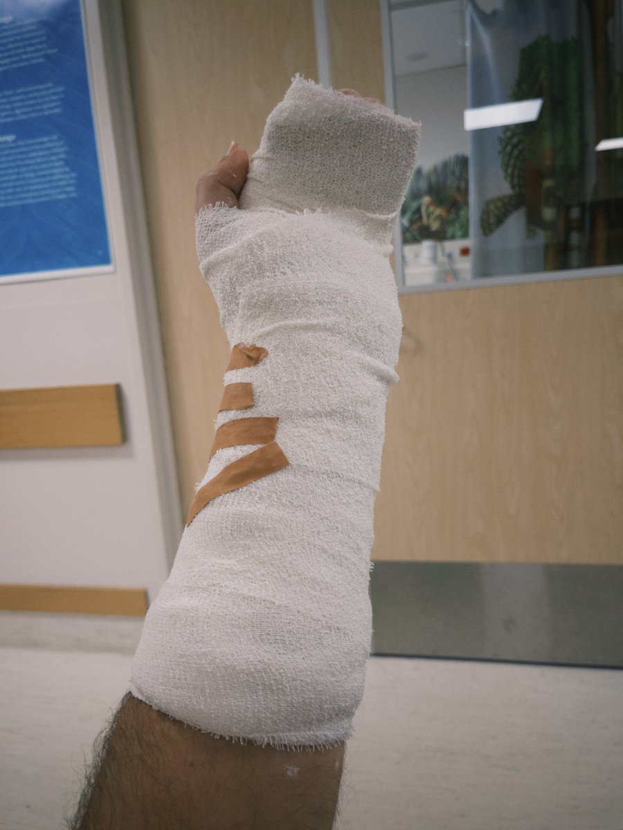 PSA: Don’t punch trees. Gotta spend the next few weeks with minecraft arms irl