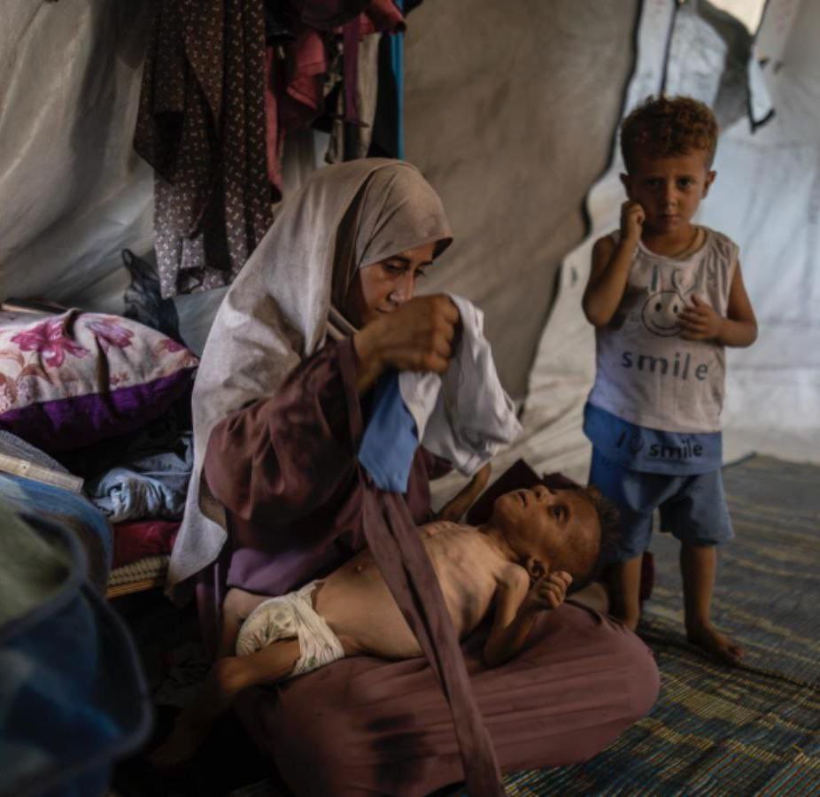 Это Мухаммад Закария Айюб аль-Матук. В отличие от своего брата, стоящего рядом на фото, Мухаммад страдает церебральным параличом.

Однако BBC, CNN, Daily Express и The New York Times использовали фото больного ребенка, чтобы шире распространить свою ложь о массовом голоде в Газе,