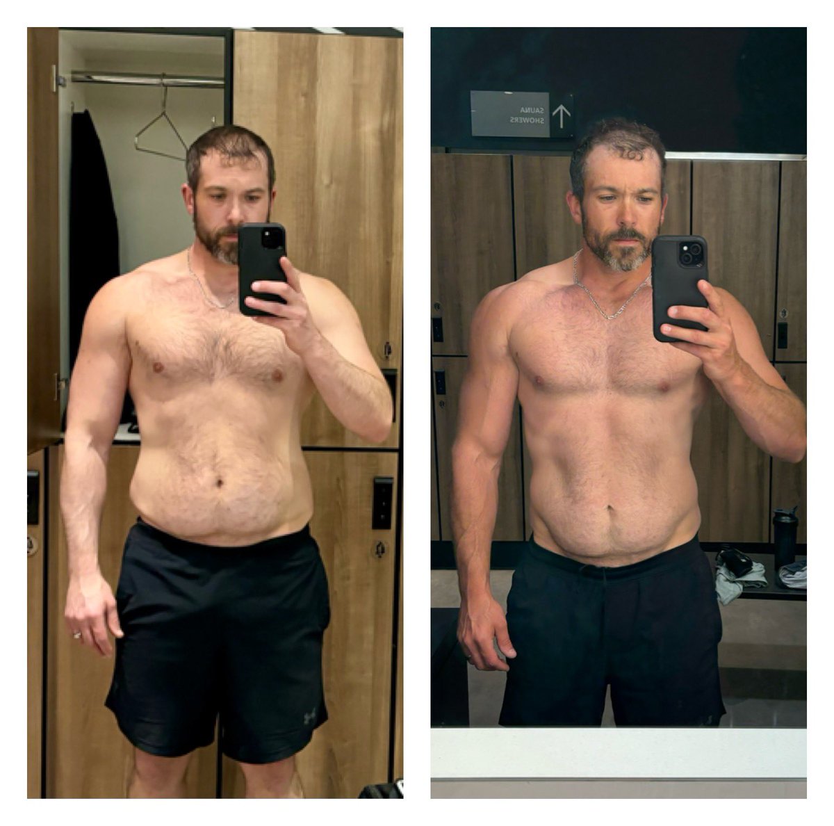 Kyle Matheson💯 (@kylematheson8) on Twitter photo In April I realized things were getting away from me, my decisions and actions weren’t aligned with my goals.
<a href="/BostonBiceps_/">BostonBiceps💯- Natural Dad Bod Specialist</a> set the plan and we went to work. Far from done and excited to see where things go from here!
April 10th 218lbs - Today 193lbs In April I realized things were getting away from me, my decisions and actions weren’t aligned with my goals.
<a href="/BostonBiceps_/">BostonBiceps💯- Natural Dad Bod Specialist</a> set the plan and we went to work. Far from done and excited to see where things go from here!
April 10th 218lbs - Today 193lbs