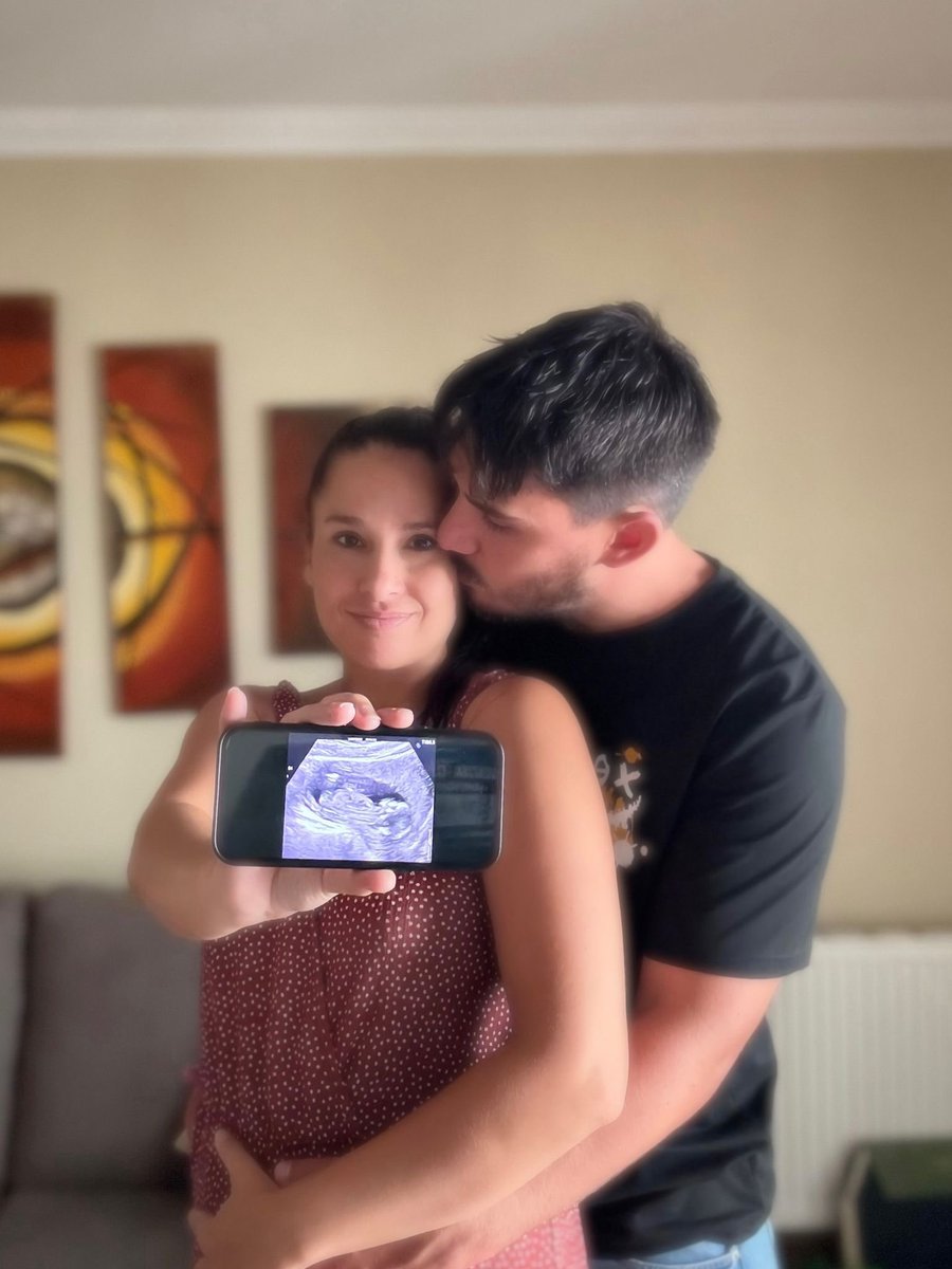 Mecalia Atlético Guardés (@atlguardes_ofic) on Twitter photo Temos unha moi boa nova que compartir… 🐣 A nosa <a href="/estelacarrera16/">Estela Carrera</a> vai ser mamá! A porteira formará parte do equipo dun xeito algo diferente esta tempada 🤰
Moitos parabéns de parte de toda a familia do Guardés, Estela e Adrián 🫶🥹🐣 Desexámosvos todo o mellor!!! Temos unha moi boa nova que compartir… 🐣 A nosa <a href="/estelacarrera16/">Estela Carrera</a> vai ser mamá! A porteira formará parte do equipo dun xeito algo diferente esta tempada 🤰
Moitos parabéns de parte de toda a familia do Guardés, Estela e Adrián 🫶🥹🐣 Desexámosvos todo o mellor!!!