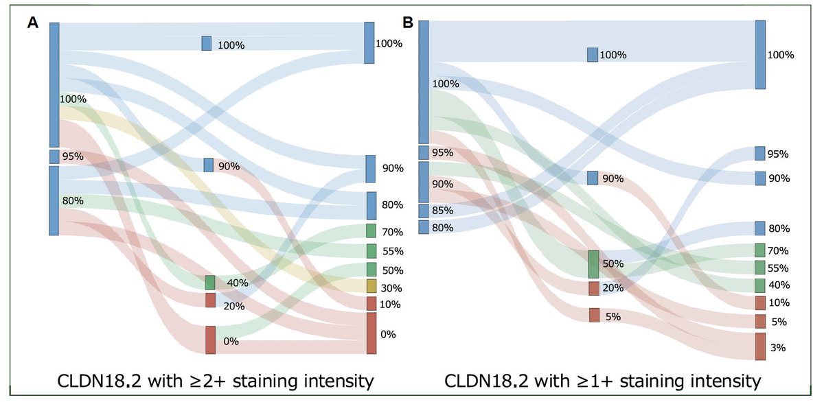 Temporal dynamics of CLDN18.2 expression following zolbetuximab treatment in advanced gastric cancer
ESMO Gastrointestinal Oncology
doi.org/10.1016/j.esmo…
🔎 65 zolbetuximab pts
👉53.3% converted to CLDN18.2-negative
🧐low level expression  often preserved, opportunity  for