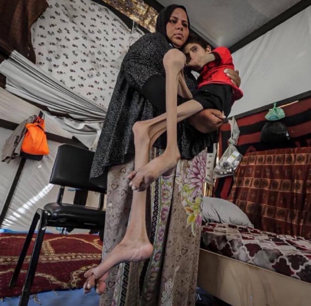 Aussie Aussie Aussie (@cohencohen81242) on Twitter photo Can someone please explain why this Gazzan child is starving, yet the mother is well fed and obsessed??? 😡😡😡😡 Can someone please explain why this Gazzan child is starving, yet the mother is well fed and obsessed??? 😡😡😡😡