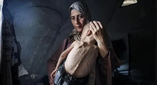 These two images are identical in purpose: dehumanizing Jews. 

Whether it’s portraying them as vampires, as the Nazis did, or as baby killers, as today’s media does, it’s the same. 

The New York Times and any outlet that published photos of children with medical conditions to