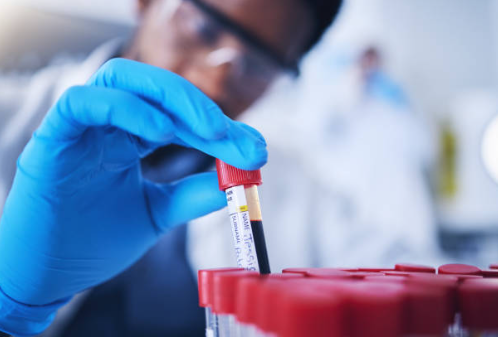 Alzheimer's Association, Northern CA & Northern NV (@alznorcalnornev) on Twitter photo Today at #AAIC25, the Association released its first evidence-based clinical practice guideline on the use of blood-based biomarker tests in specialty care—a significant step forward in transforming Alzheimer’s disease diagnosis. bit.ly/477otMV Today at #AAIC25, the Association released its first evidence-based clinical practice guideline on the use of blood-based biomarker tests in specialty care—a significant step forward in transforming Alzheimer’s disease diagnosis. bit.ly/477otMV