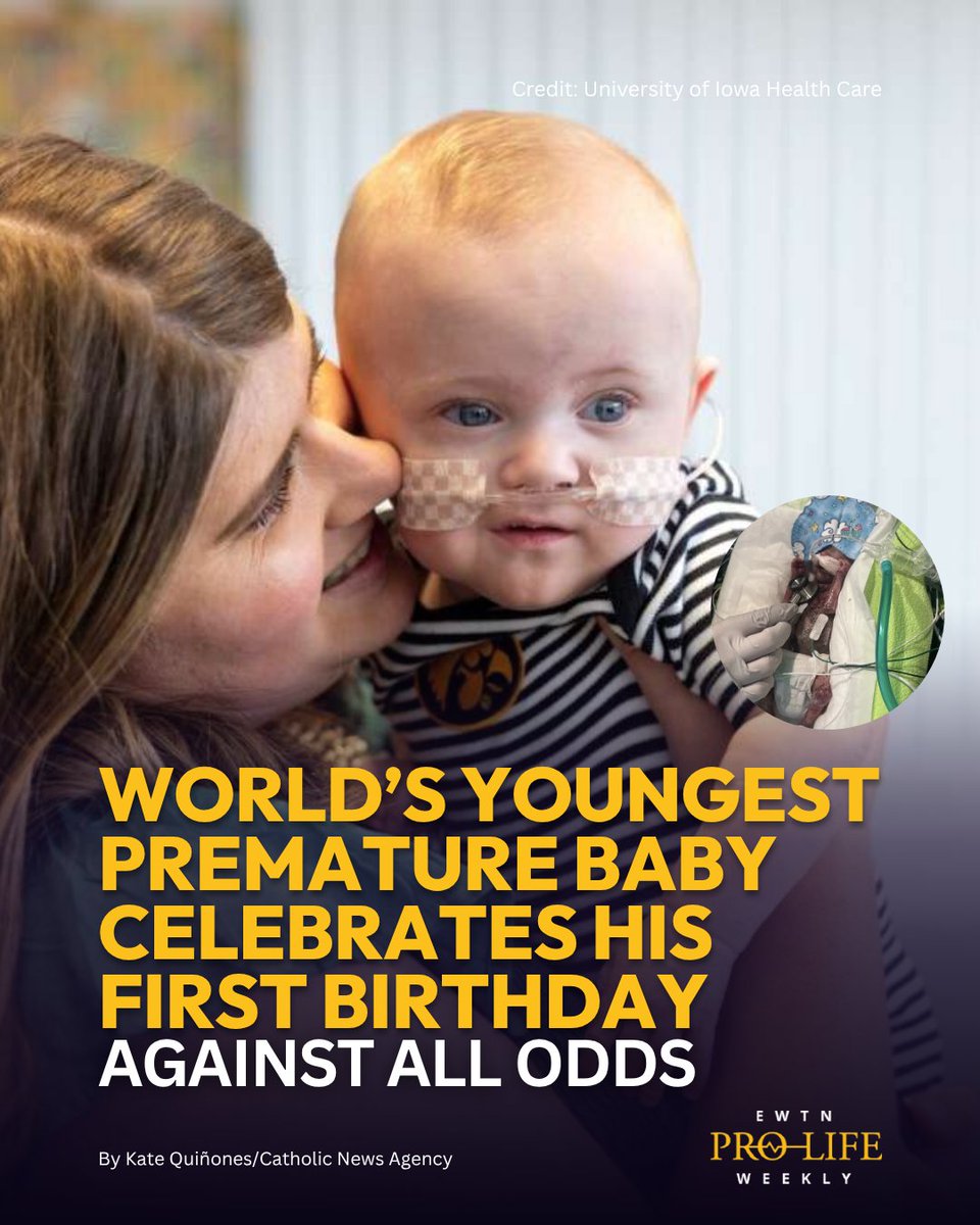 The world’s youngest premature baby, who was born more than four months early, celebrated his first birthday this month. 🎉

Read more on hubs.la/Q03zj9wp0