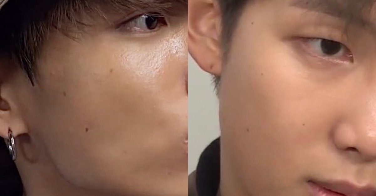 ishqpjm's tweet photo. the fact that nobody knows that how jungkook and namjoon have matching moles not only in just one place but many https://t.co/528bWNLqSB