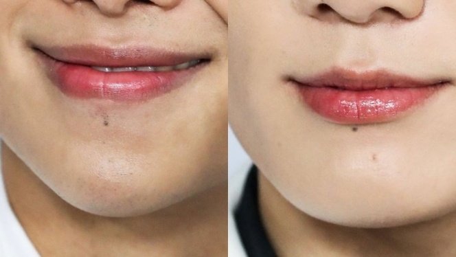 ishqpjm's tweet photo. the fact that nobody knows that how jungkook and namjoon have matching moles not only in just one place but many https://t.co/528bWNLqSB