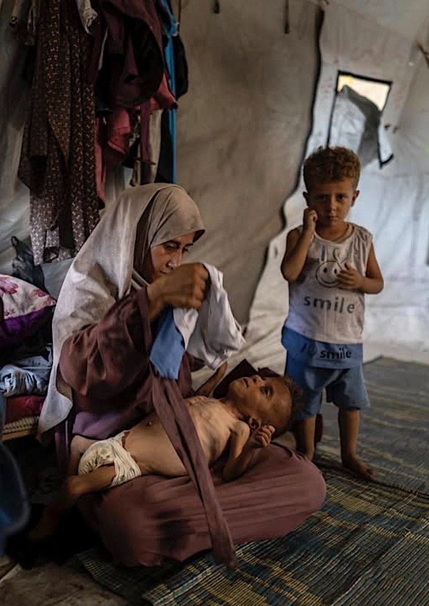 Jaime Kirzner-Roberts (@jaimekr) on Twitter photo The <a href="/nytimes/">The New York Times</a> admits the emaciated boy they splashed on their front page as ‘proof’ of famine in Gaza was actually suffering from a serious medical condition – which is why his family all look healthy.
Exploiting a child’s illness to push a political narrative is reprehensible. The <a href="/nytimes/">The New York Times</a> admits the emaciated boy they splashed on their front page as ‘proof’ of famine in Gaza was actually suffering from a serious medical condition – which is why his family all look healthy.
Exploiting a child’s illness to push a political narrative is reprehensible.