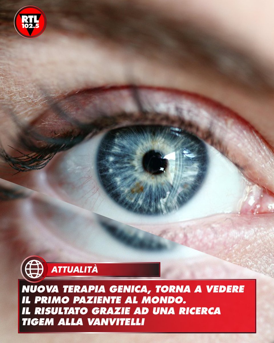 👁️ Torna a vedere il primo paziente al mondo trattato con una nuova #terapiagenica a 'doppio vettore' per una rara malattia della retina. Il risultato sul primo paziente al mondo trattato, ottenuto dalla Clinica oculistica dell'Università degli Studi della #Campania