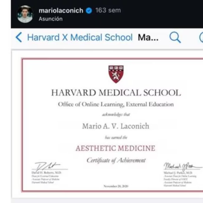 delpynews's tweet photo. ▶️ TENÍA VARIAS DENUNCIAS EN SU CONTRA | ​​🧐

🚨Abren sumario a supuesto médico en estética por utilizar título falso y operar en clínica no habilitada por la Superintendencia de Salud.

📌Se trata de Mario Armando Vera Laconich, propietario de Lakonic Esthetic Lab, quien se presentaba como doctor con título PhD.

⚠️Se verificó que solo cuenta con el registro de licenciado en Farmacias. Además, comercializaba ilegalmente inyectables y cremas a través de redes sociales.

Fuente: ABC Color.