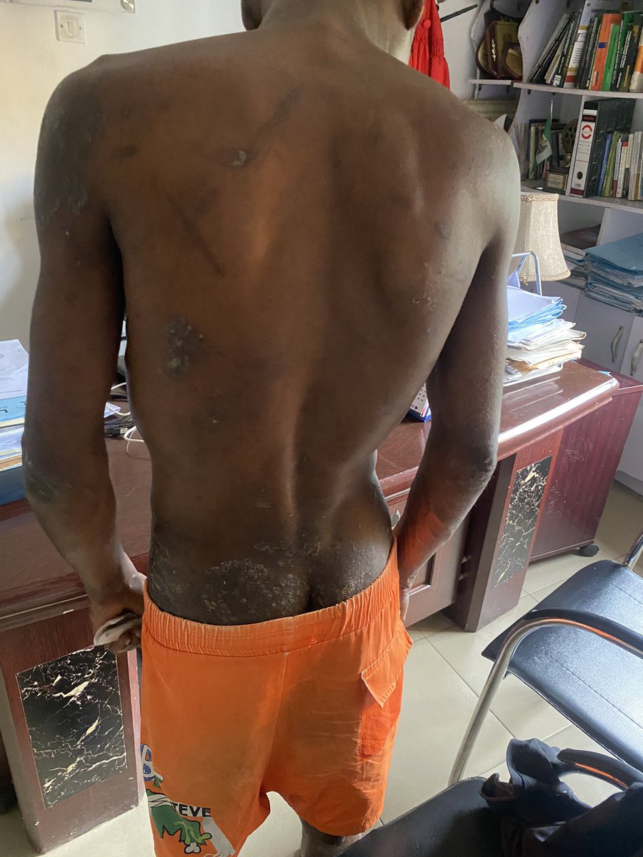 At the young age of 12, Emeka Nzeruike was thrown into prison in 2015 ,alone, afraid &amp;forgotten. No trial, No lawyer ,No voice .Today, We stood where justice had long been silent. We held his hands, walked him out of the court room &amp; gave him back his future. Welcome back Emeka.