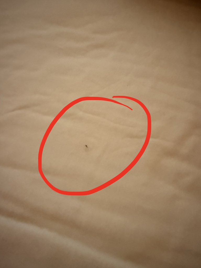 qftZeGo's tweet photo. @claim_airbnb 
@AirbnbHelp 
@Airbnb 

Air bnb supports bugs? https://t.co/NTkBlZmxeO