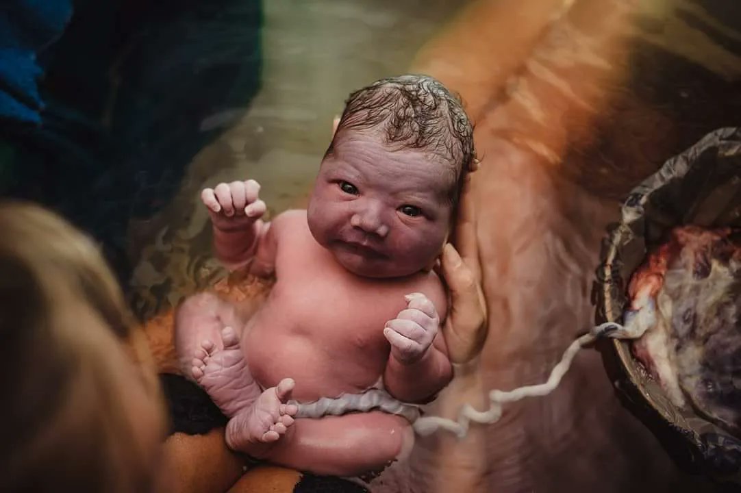 TAKE VITAMIN C WHILE PREGNANT!!!
In 1971, a doctor named Frederick Klenner, who was practicing in Reidsville, North Carolina, published a paper that included mention of his series of 300 CONSECUTIVE uncomplicated births. His secret to easy births: he instructed all his pregnant