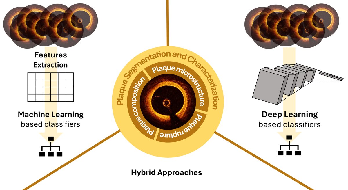SusieSu11733465's tweet photo. 🚨#RCM New #Review

"Artificial Intelligence-based Approaches for Characterizing Plaque Components From Intravascular Optical Coherence Tomography Imaging: Integration Into Clinical Decision Support Systems"

🔍Read more: 
https://t.co/j9LU3biyFk

#Cardiology #AIinMedicine #IVOCT https://t.co/eJC11Y2wpo