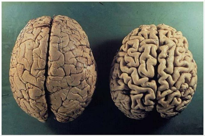 Todos quieren cuidar su cuerpo…

Pero nadie cuida su cerebro.

La mayoría de las personas simplemente lo ignoran hasta que algo sale mal.

Por eso, aquí tienes todo lo que necesitas saber para curar y proteger tu cerebro: 🧵