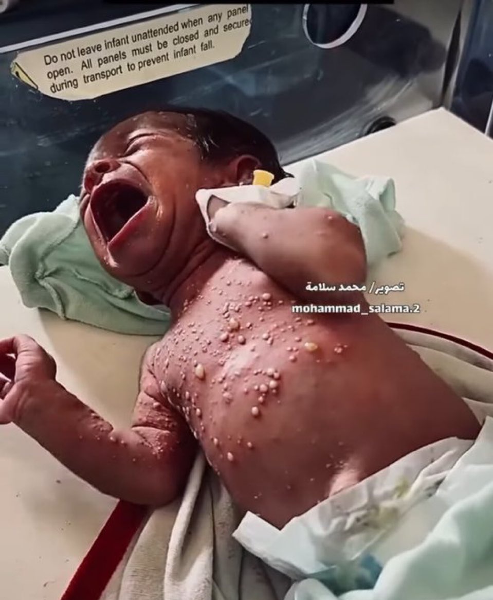 We are so sorry 🇵🇸💔