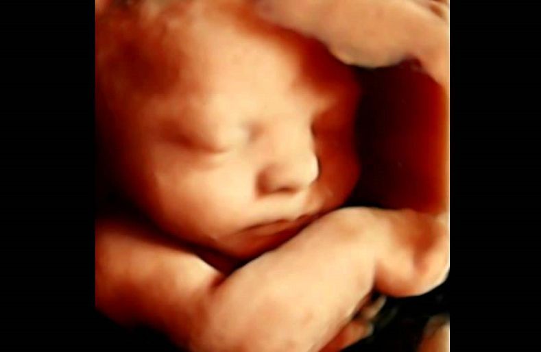 As a Nurse, I Know a Fetus is an Unborn Baby With a Beating Heart buff.ly/1f61tPl
